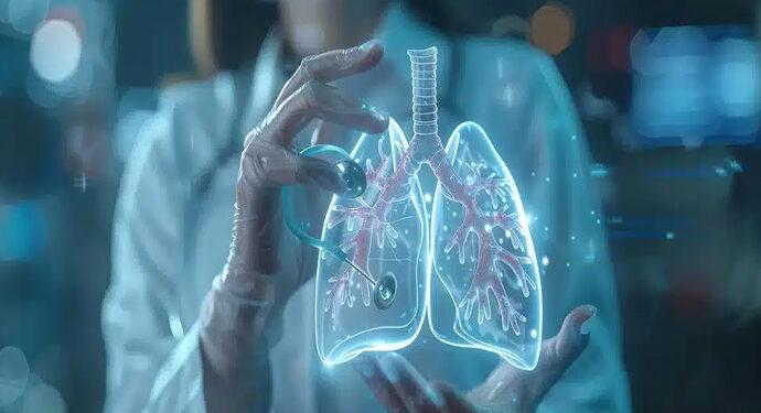 Akses Terapi dan Obat Inovatif Untuk Kanker Paru di Indonesia Terendah di Asia Pasifik