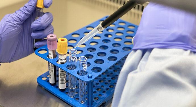 Living Lab Ventures Berinvestasi di Sektor Contract Research Organization